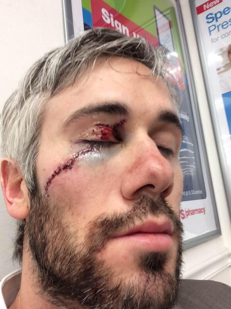 Here's What an NHL Player's Face Looked Like After a Freak Accident on the Ice