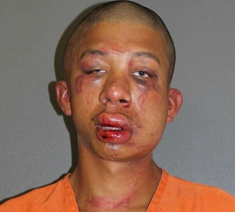 He's Going to Learn...Why I Let Him Live': Man Who Was Beaten to a 'Bloody Puddle' by a Horrified Father Receives His Sentence
