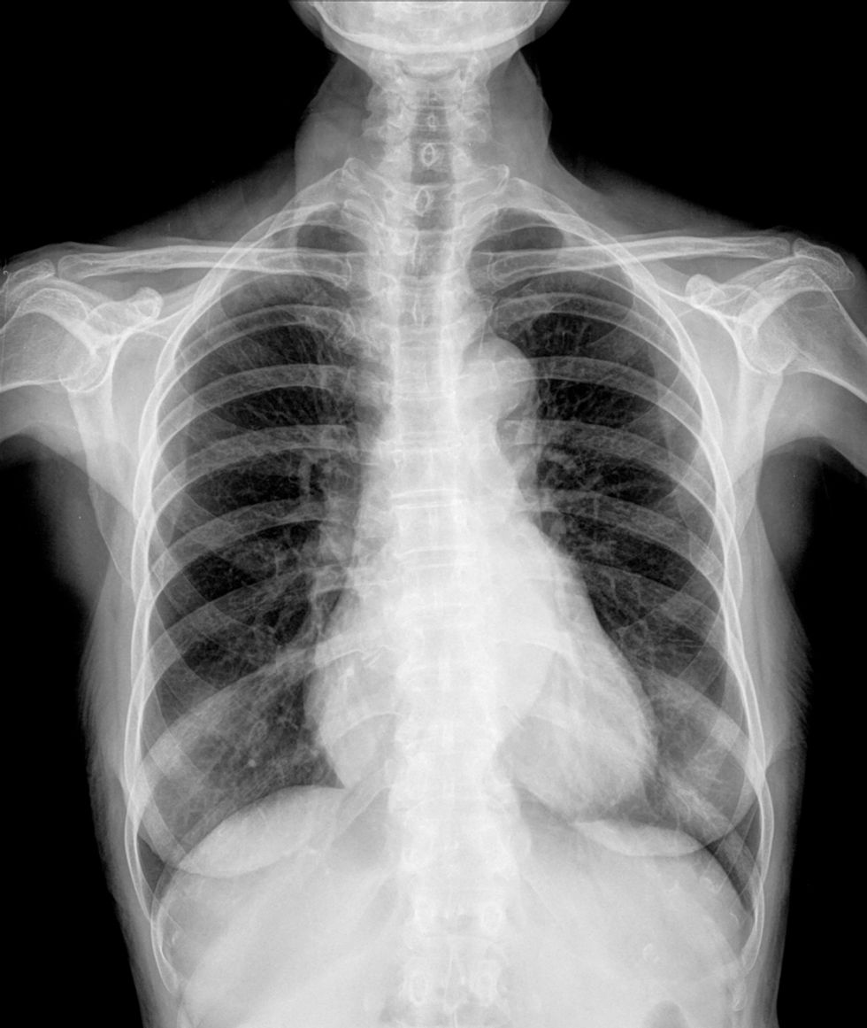 Disgusting Creature Removed From Boy's Throat After He Drank Pond Water
