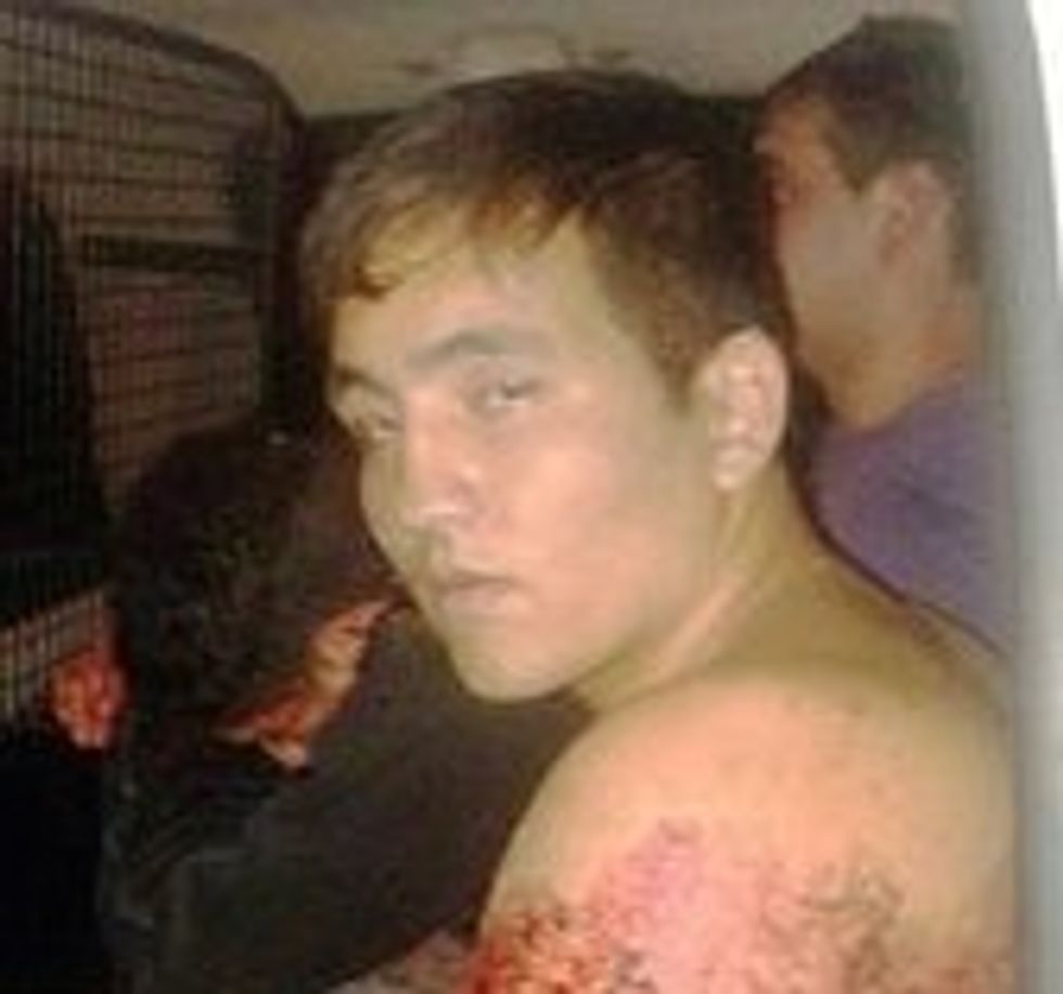 Four Burglars With Pistols Went Up Against One Homeowner With a Samurai Sword — Graphic Photos Show Who Won