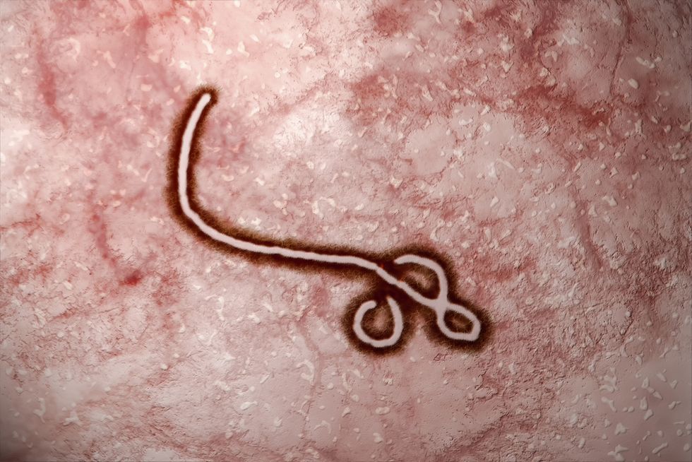 Health Officials Warn Ebola Survivors Against Having Sex After Virus Found in Fluid After 175 Days