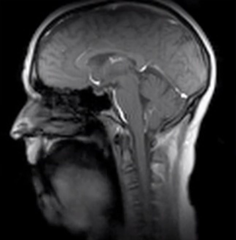 If I Only Had a Brain' Sung Like You've Never Seen It Before
