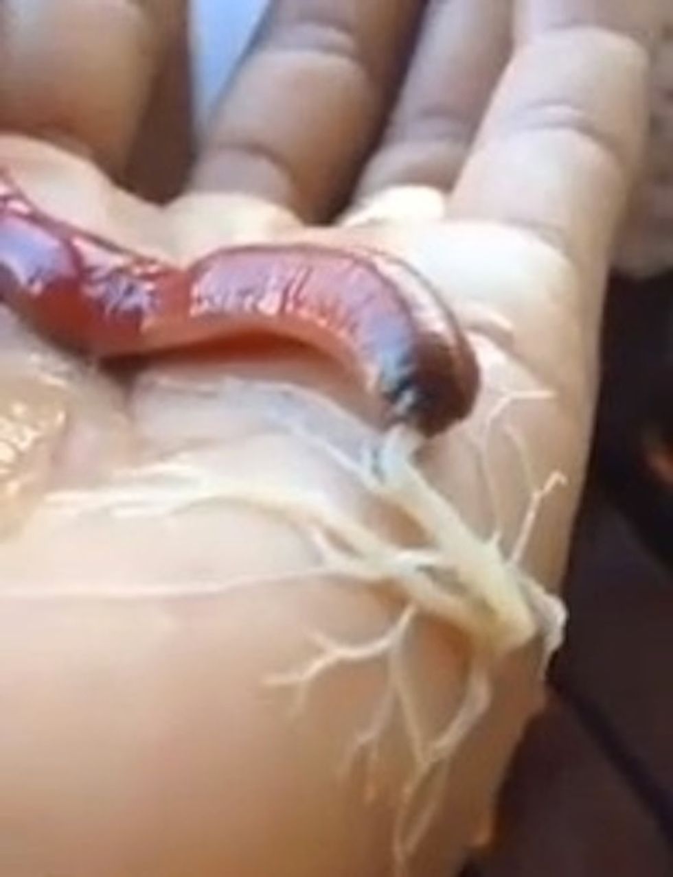 This May Be the Most Disgusting Video of a Worm You've Ever Seen