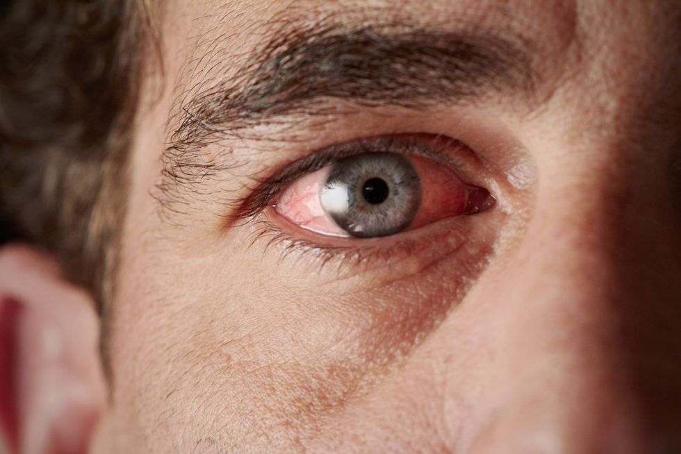 American Ebola Patient Considered Cured of the Disease Saw Something Very Strange Happen to His Eye