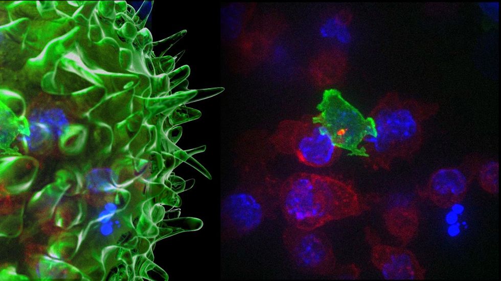 Watch How Your Body's Own 'Serial Killer' Cells Viciously Fight Cancer Cells in New Video