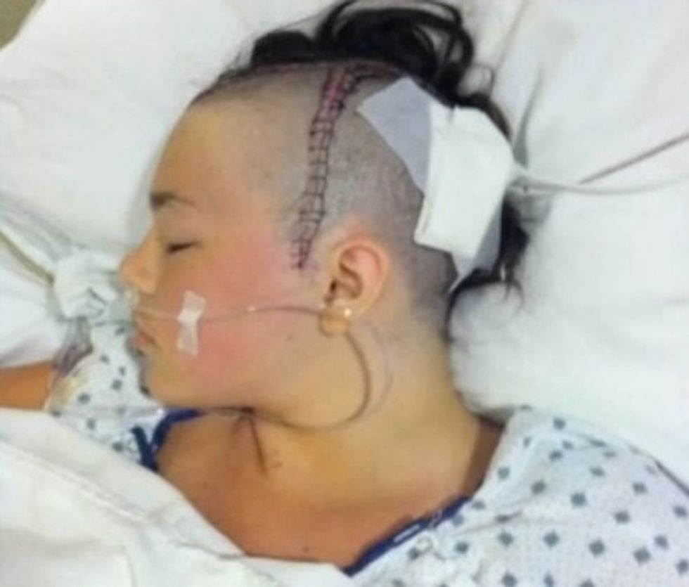 Teen Started High School With Surgery That Removed Half Her Brain. She’s Now Getting Ready to Walk Across the Graduation Stage