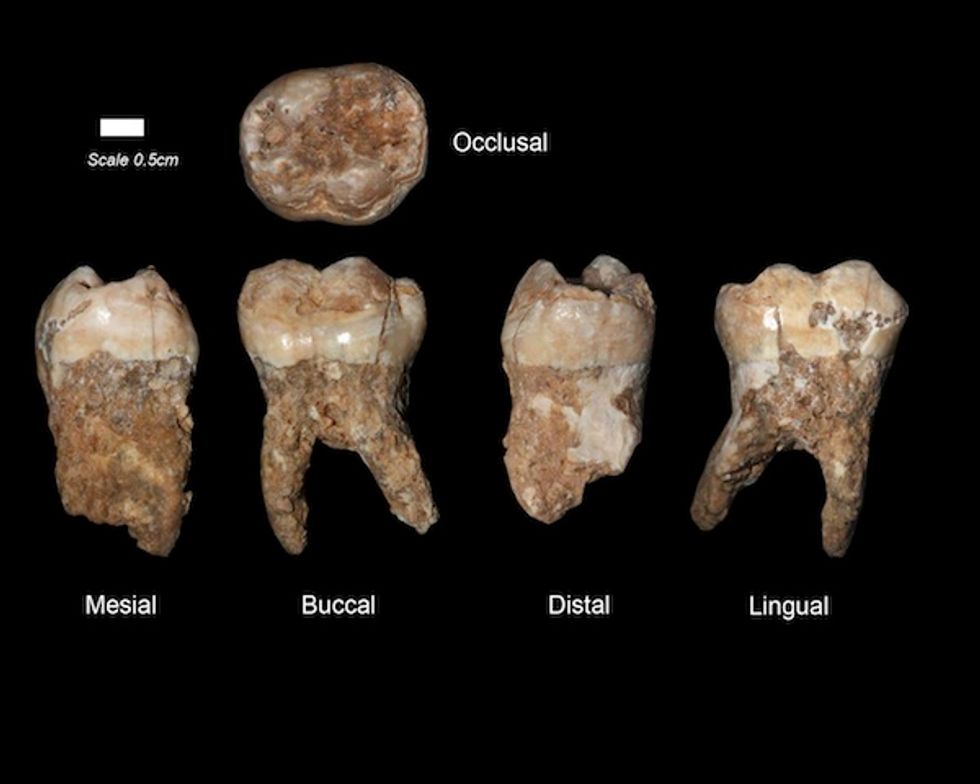 Scientists Find Plaque on 400,000-Year-Old Teeth, and It Tells Us a Lot About Them