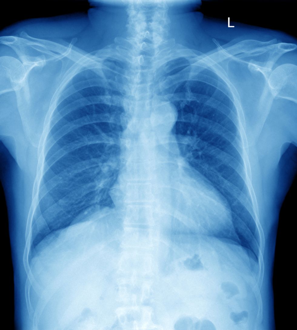 91-Year-Old Woman Received an X-Ray After a Fall and What Doctors Found in Her Abdomen Was 'Beyond Any Standard Medical Explanation