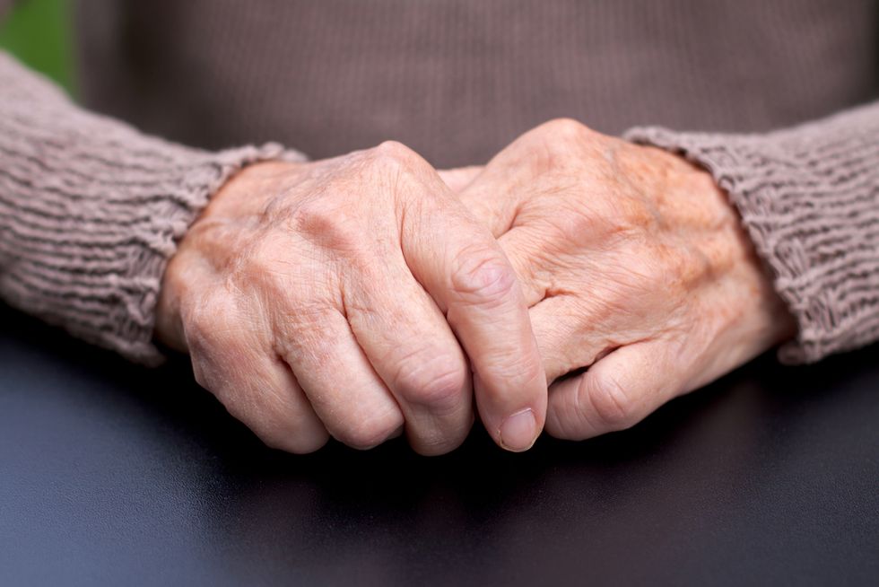 Why an 'Alarming' Number of Alzheimer’s Patients Are Women