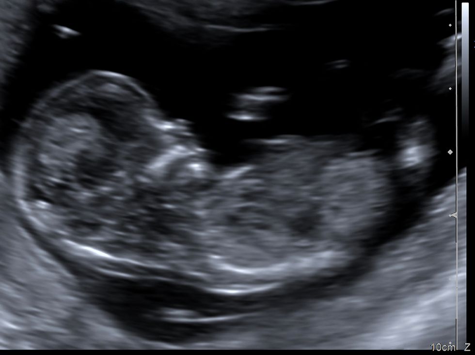 Woman’s Heartbreaking Letter to Father of Baby She Says She Aborted: 'There Are No Words\