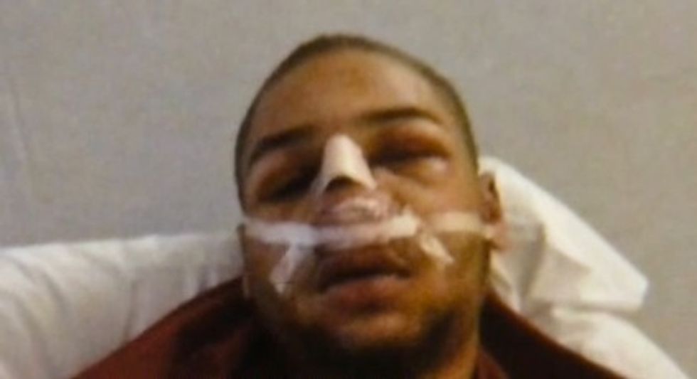 ‘Swatting’ Prank Ends Horribly for Victim — and He Has the Injury to Prove It