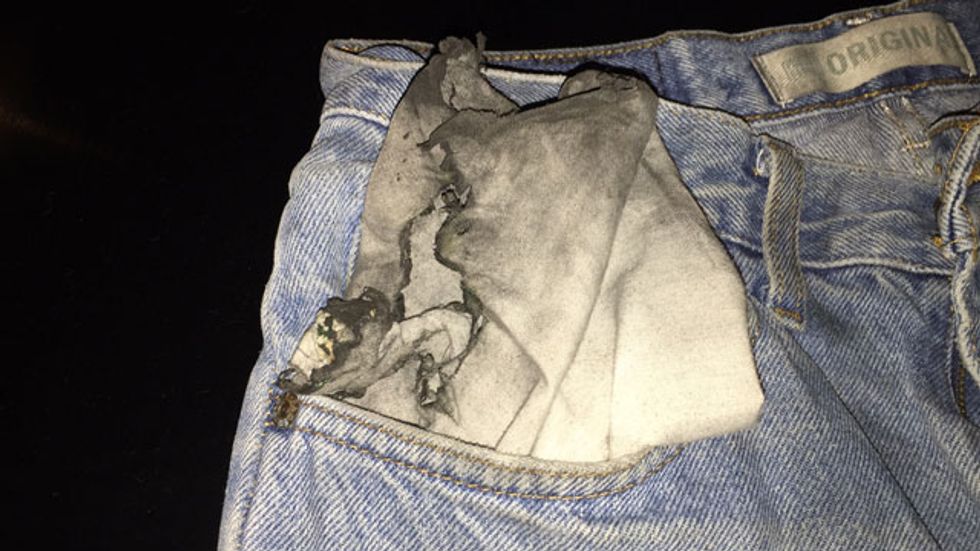 E Cig Blows Up In Pocket