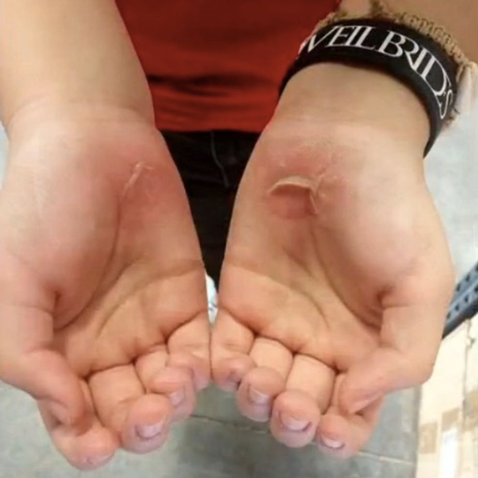 Texas School Launches Investigation After Students Get Blisters From 'Bear Crawls