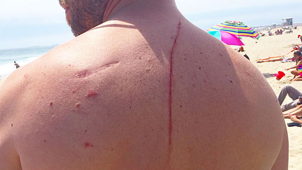 Shark Attack Forces Man to Go to Hospital. Unexpected Discovery Doctors Make Leaves Him Thankful for Attack