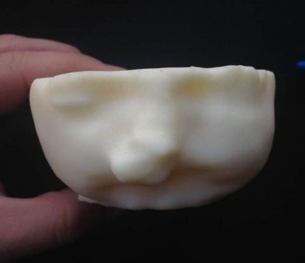 Mother 'Terrified' to Learn a Mass Growing on Her Unborn Baby's Face Might Have Prevented Him From Breathing. Here's How 3-D Printing Helped Doctors