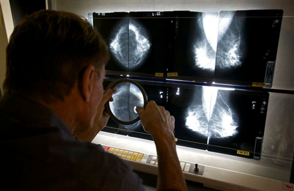 American Cancer Society Updates Guidelines on Breast Cancer Screening