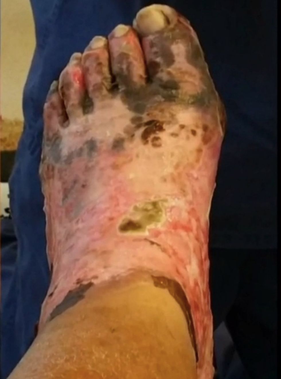 His Persistent Wife Convinced Him to Get a Pedicure With Her — Shock Photos of the Aftermath Show Why He’ll Likely Never Return