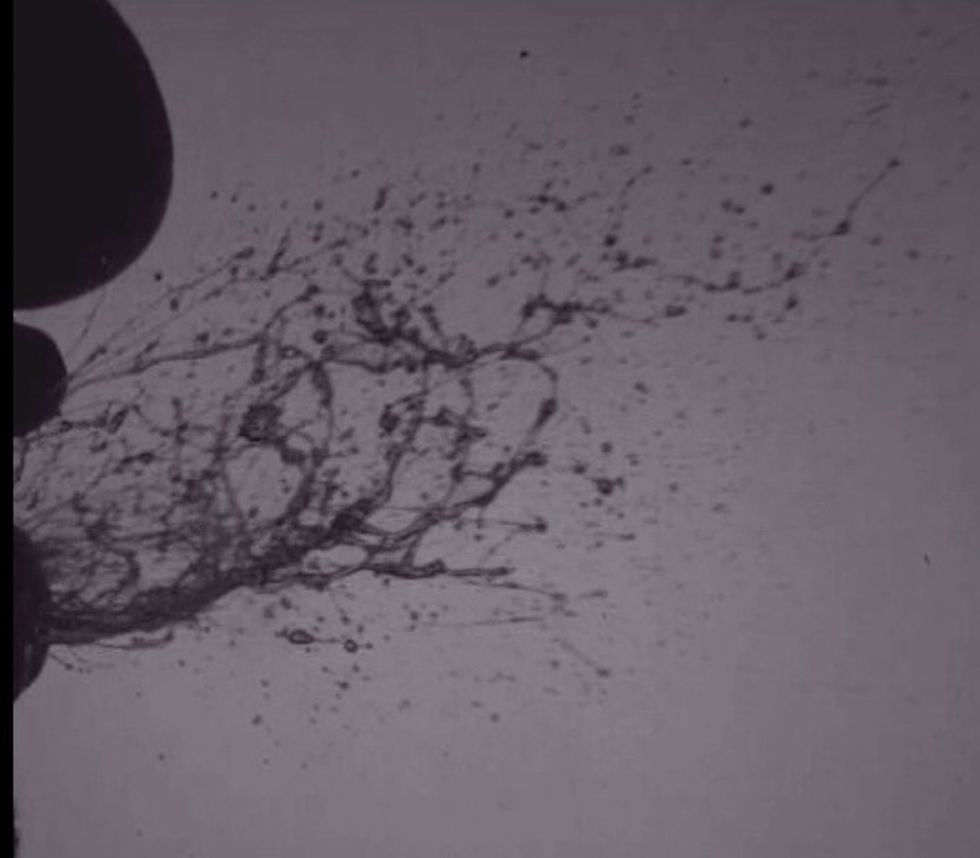 Slow-Mo Video Shows Just How Nasty a Sneeze Can Be
