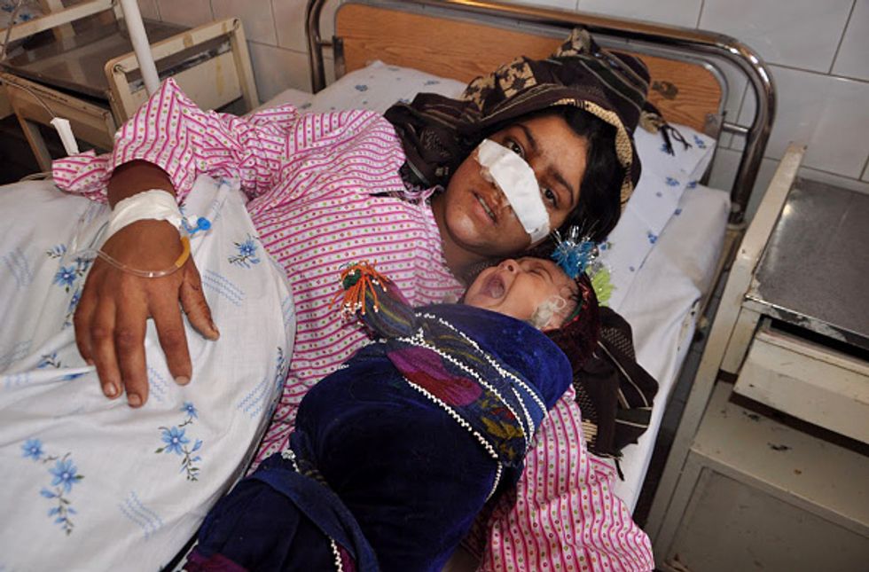 Gruesome Attack on Young Woman Highlights Widespread Domestic Violence in Afghanistan