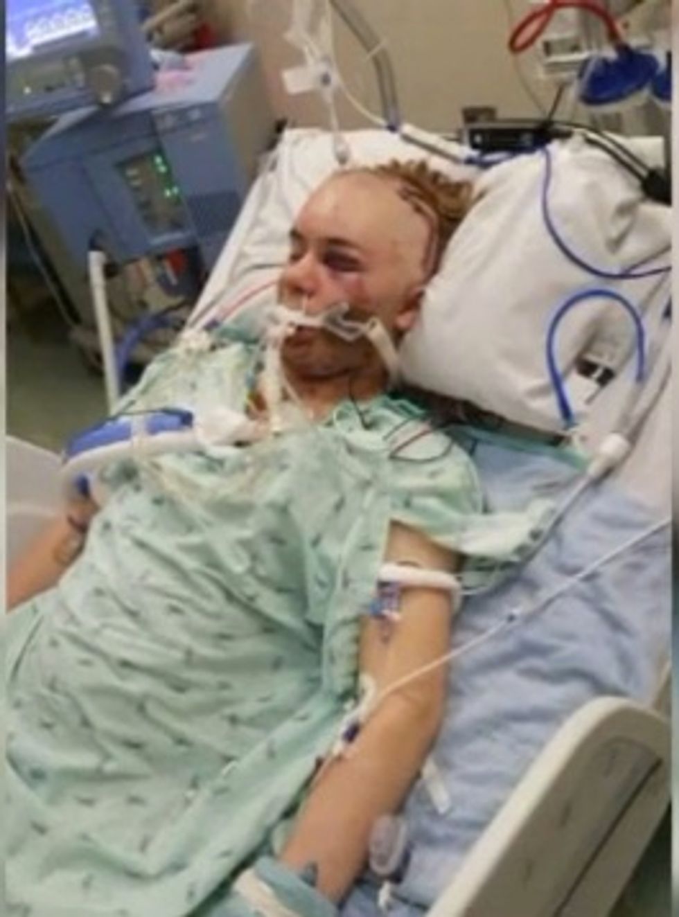 14-Year-Old Attempts Popular 'Duct-Tape Challenge' — and Nearly Loses His Life