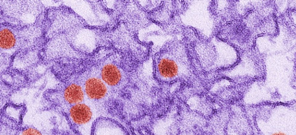 Zika Virus Could Threaten Blood Supply During Critical Winter Months When Donations Are Typically Low