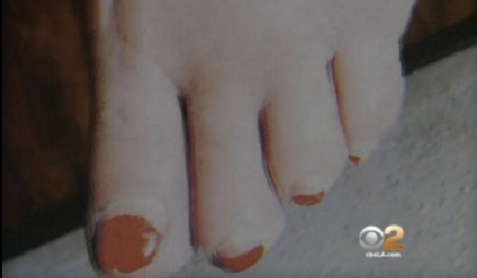 California Woman Blames Botched Pedicure for Loss of Her Pinky Toe