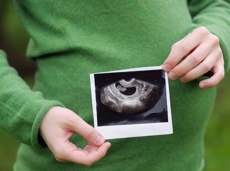 Mom: 'I Had an Abortion Because I Love My Son