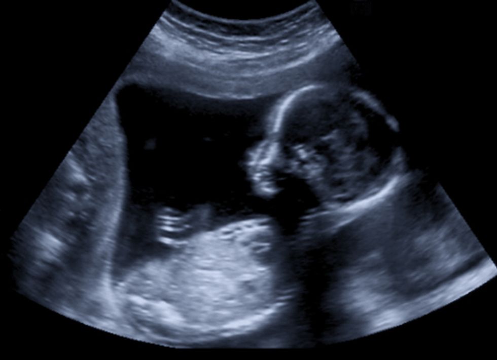 North Dakota Ordered to Pay $245,000 in Attorney Fees to Abortion Rights Group