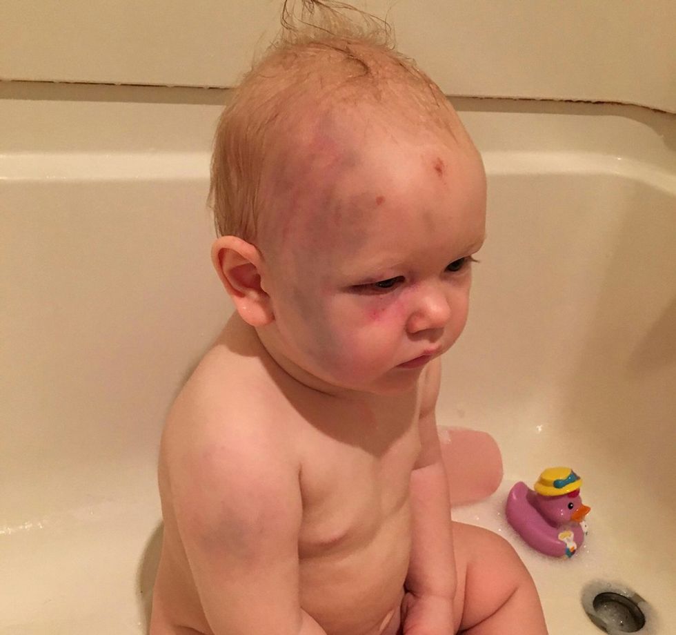 Parents Find Horrific Injuries on 1-Year-Old Son — And They’re Stunned When They Learn Why Charges Are Being Dropped