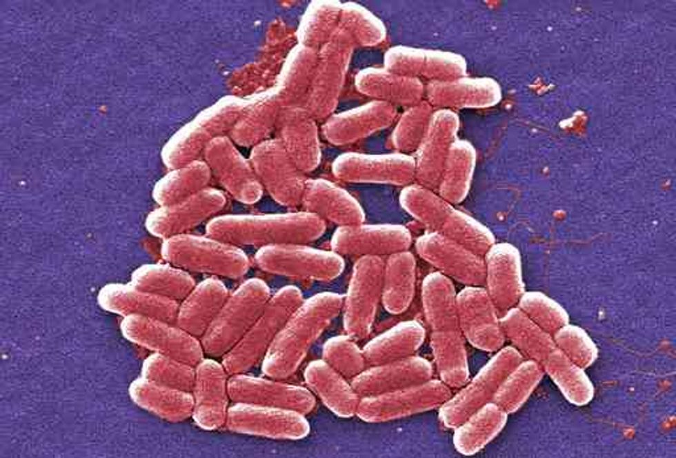 Report: Dreaded Drug-Resistant Super Bug Hits U.S. for First Time