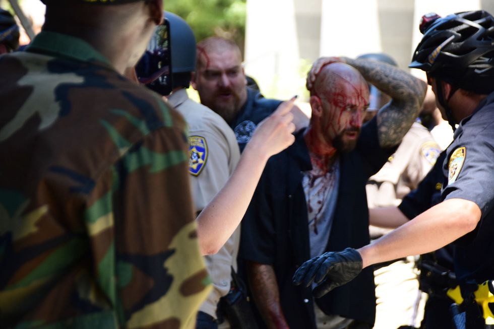 10 Hospitalized in Violent Clash Between Right-Wing Protesters, Counterprotesters at California Capitol