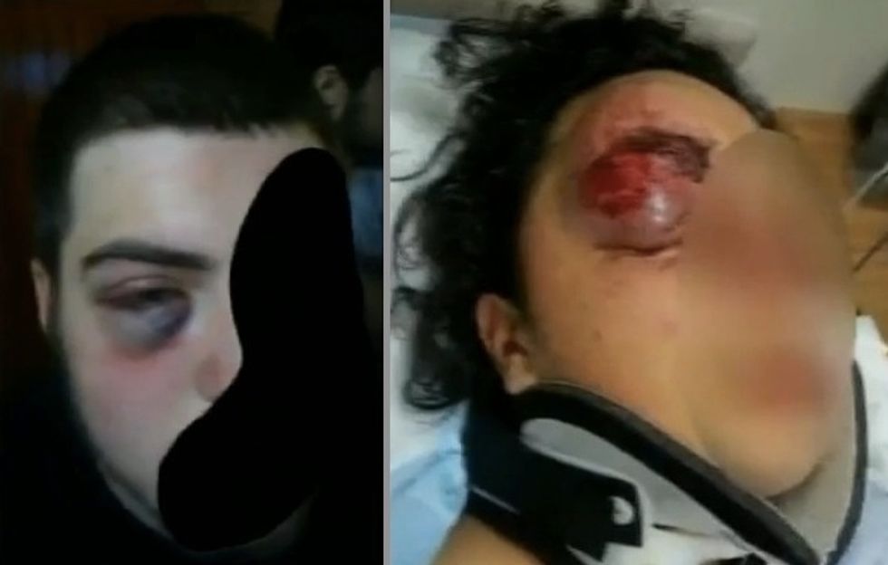 Mosque Says Brutally Beaten Muslim Teens Are Hate Crime Victims. Here's Why Police Disagree.