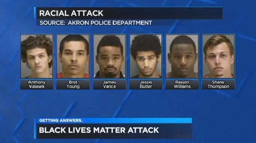 Group of Men Shouting ‘Black Lives Matter’ Brutally Attack White Victims, Beating One Unconscious: Police