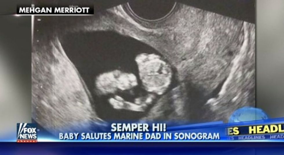 ‘I Almost Cried’: Unborn Baby ‘Salutes’ Former Marine Dad in Sonogram Image 