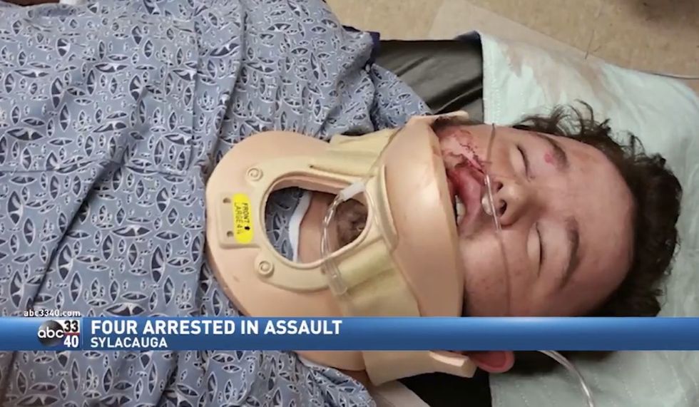 Four arrested in connection with white teen's brutal beating, possibly sparked by Black Lives Matter argument
