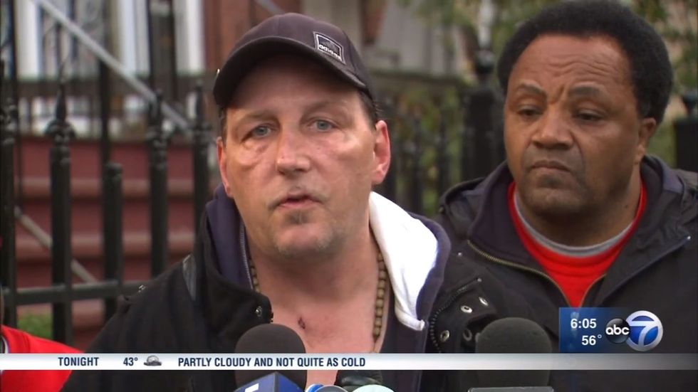 Chicago Trump supporter explains why he didn't fight back when he was beaten by a mob of teenagers