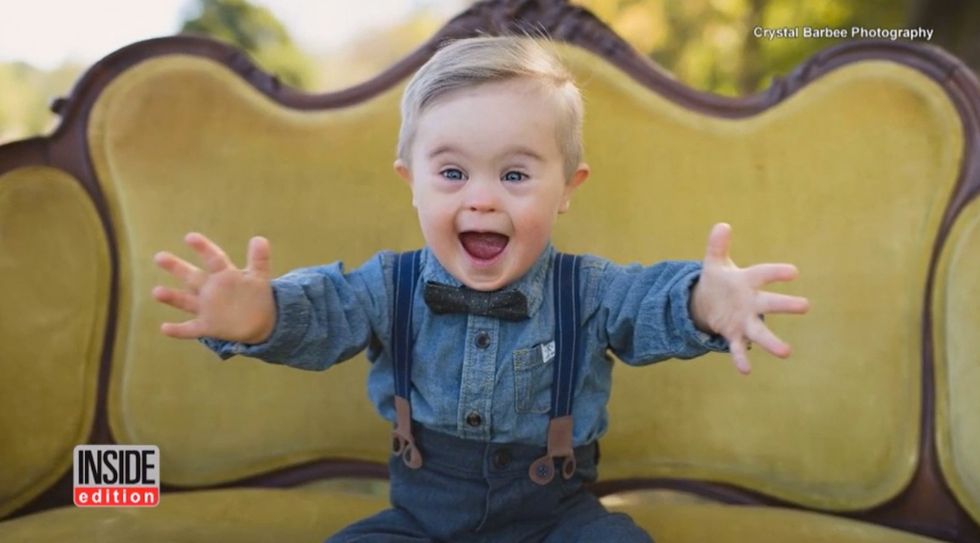 Toddler with Down syndrome makes modeling debut in advertising campaign