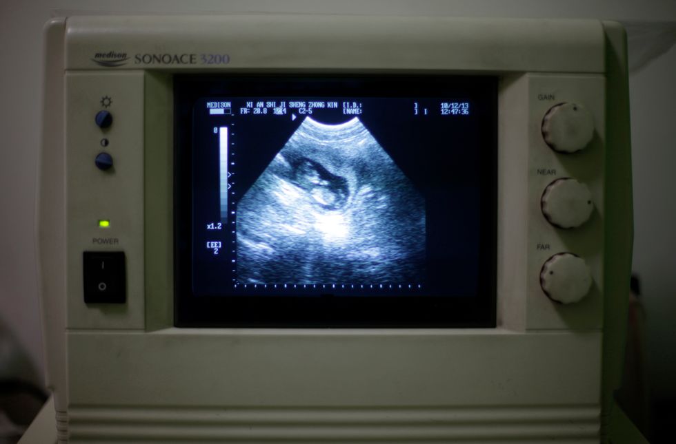 Ohio Senate passes controversial abortion bill