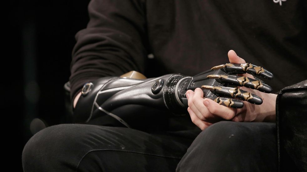 Bionic implants to surpass human physical limitations expected by 2030