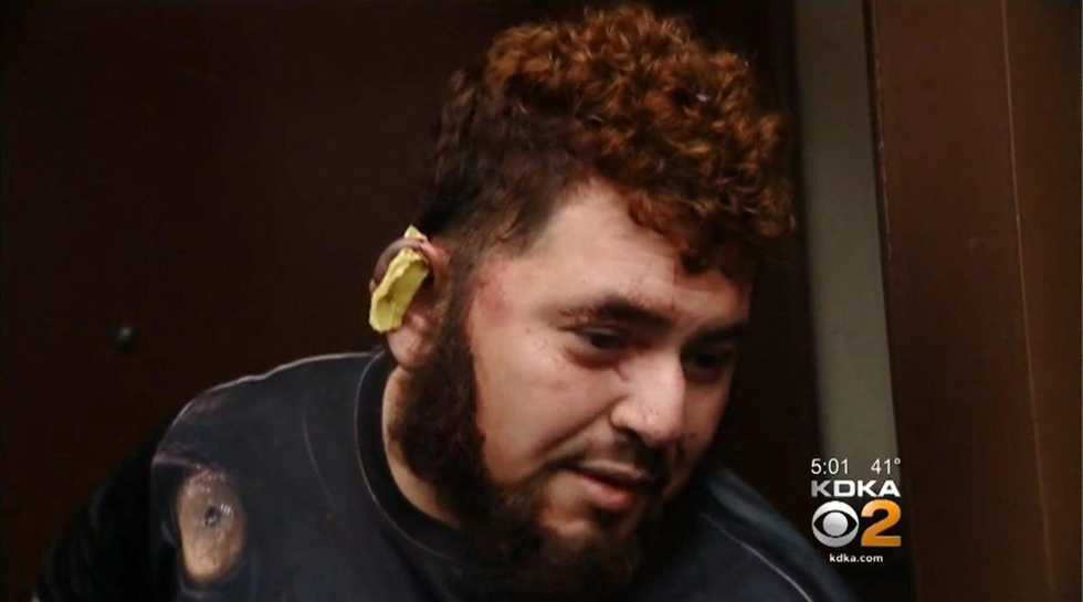 Pittsburgh man allegedly bit off roommate's ear following argument about Trump