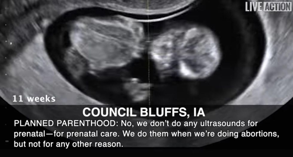 New video shows Planned Parenthood staffers saying they only do ultrasounds for abortions