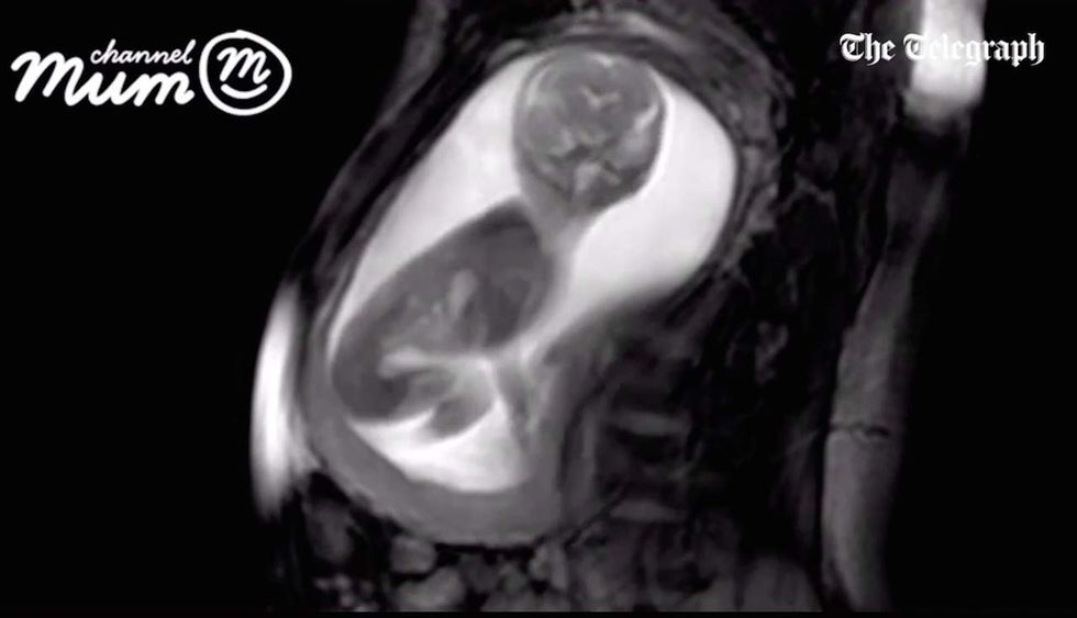 New technology captures clear footage of an unborn baby in the womb