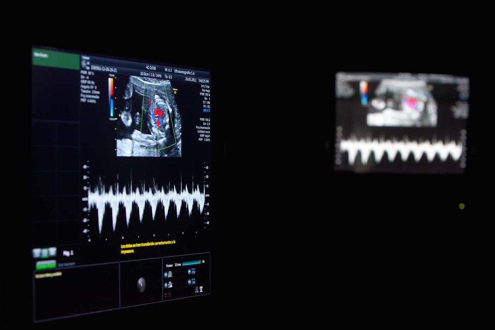 Husband pens viral note to wife carrying child to term following devastating prenatal diagnosis