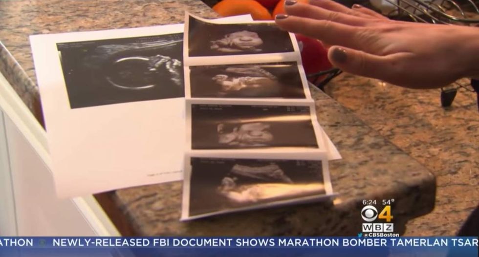 Father to run Boston Marathon in honor of his unborn daughter with Down syndrome