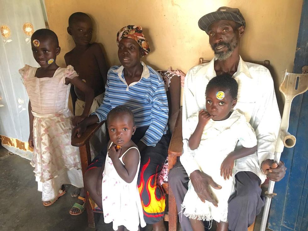 Saving the boy in Kenya who played too close to the fire