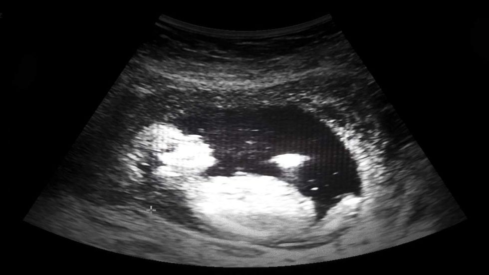 New research shows babies first learn language in the womb