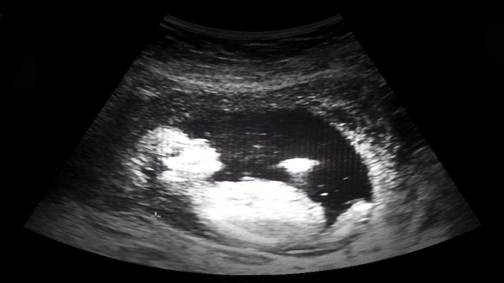 New research shows babies first learn language in the womb