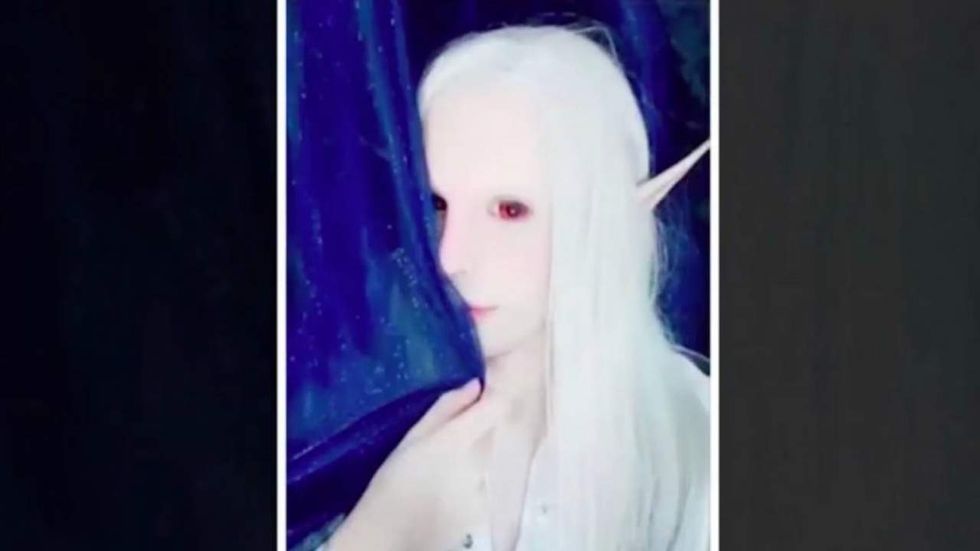 Bullied as a teen, Argentine man spends tens of thousands to look like an 'elf