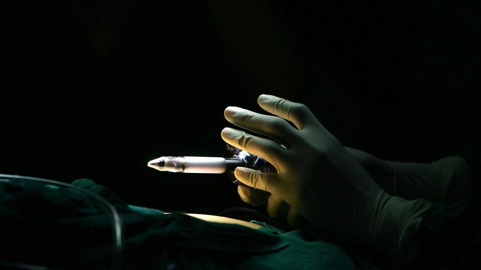 Glenn: Landmark case with conjoined twins set the stage for Charlie Gard