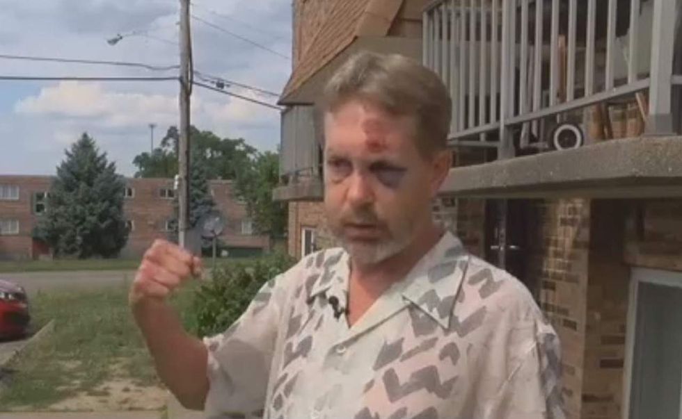 Sucker punch from behind on city sidewalk knocks out man, 54: 'This generation, I don't know.